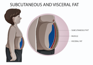 Ilustración de grasa visceral y grasa subcutánea